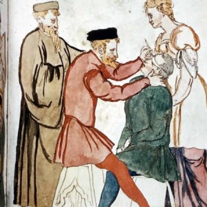Medicina nel Medioevo: operazione di cataratta