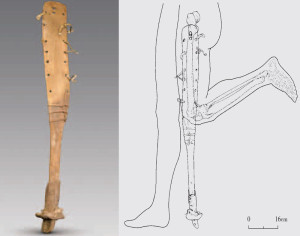 La protesi con zoccolo di cavallo risalente a circa 2200 anni fa recentemente ritrovata in Cina