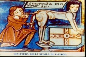 Cura chirurgica delle emorroidi nel Medioevo (il dipinto si riferisce alla Scuola Salernitana)